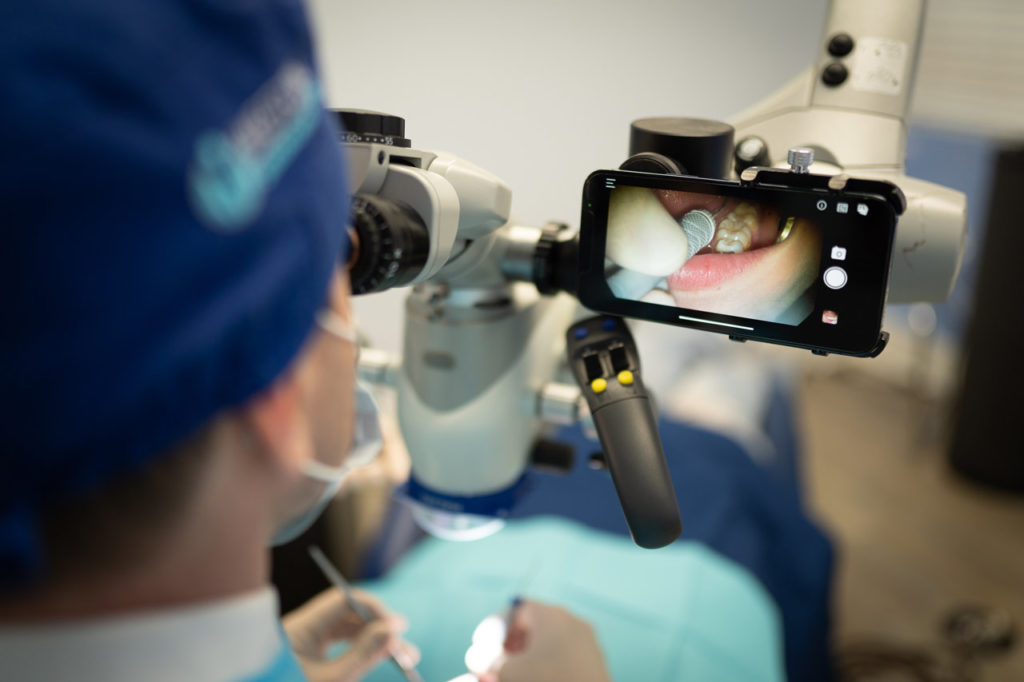 Surgical Microspcope