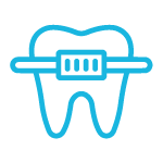Braces